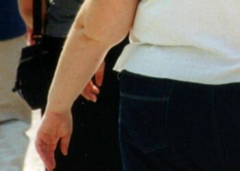 Una morte per malattie infettive su 10 è legata all’obesità, lo studio