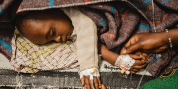 Nel 2024 sono morti 4,9 milioni di bambini sotto i 5 anni